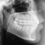 Radiologia Odontológica em Araguaína