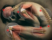 Tratamento de Dor em Araguaína